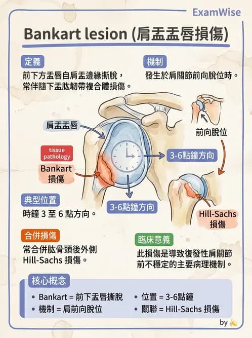 物治 - 肩關節不穩定與盂唇損傷 - AI 圖文解析預覽