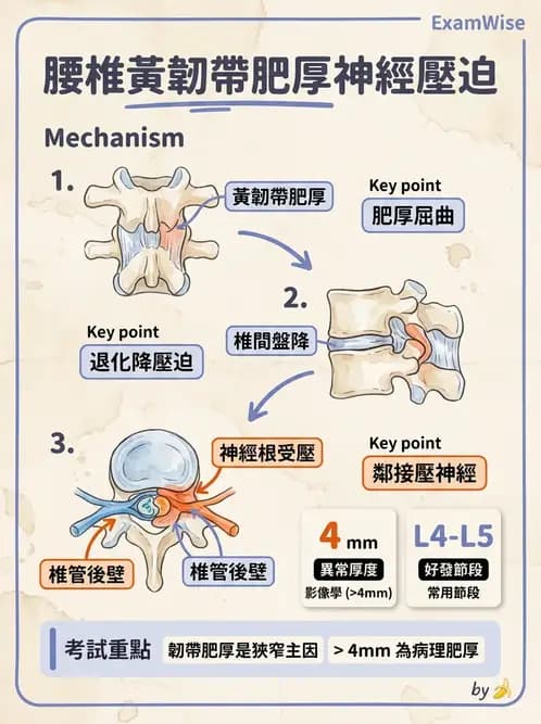 物治 - 腰椎椎間盤與脊椎狹窄 - AI 圖文解析預覽