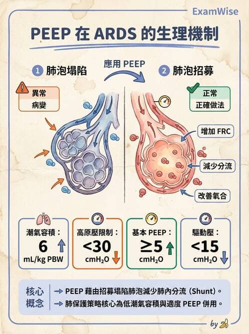 護理師 - 呼吸衰竭與胸腔護理 - AI 圖文解析預覽