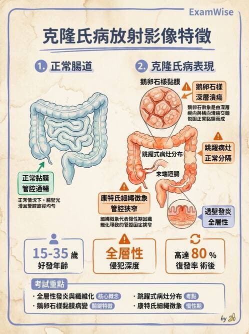 內專 - 發炎性腸道疾病 - AI 圖文解析預覽