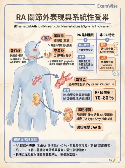 RA - 類風濕性關節炎 - AI 圖文解析預覽