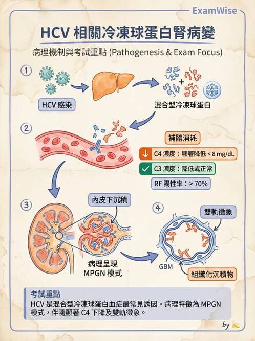 內專 - 繼發性腎絲球腎炎 - AI 圖文解析預覽