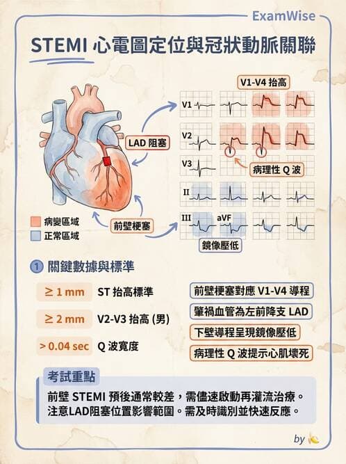 內專 - 急性冠心症 - AI 圖文解析預覽