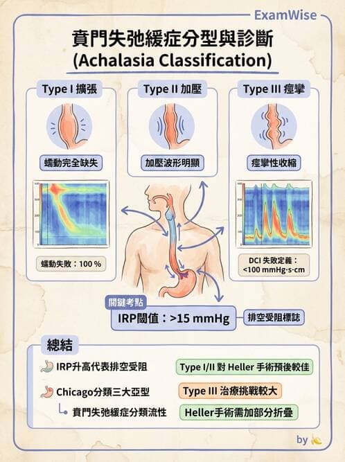 內專 - GERD、Barrett's食道與食道炎 - AI 圖文解析預覽