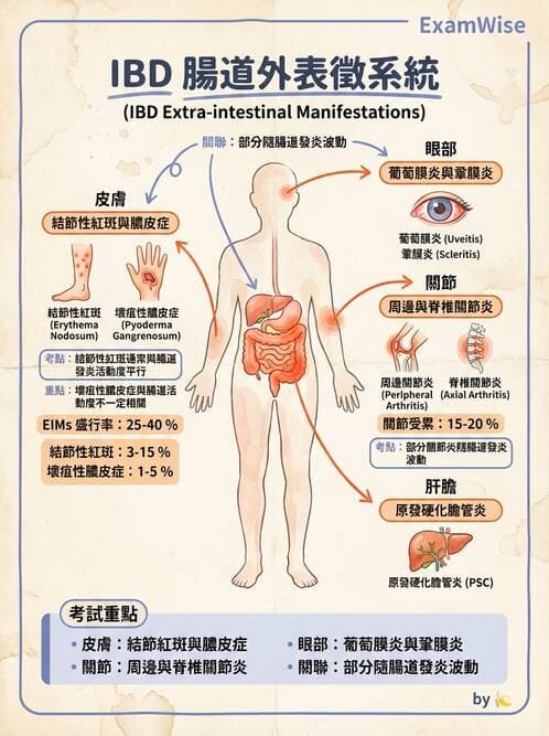內專 - 發炎性腸道疾病 - AI 圖文解析預覽