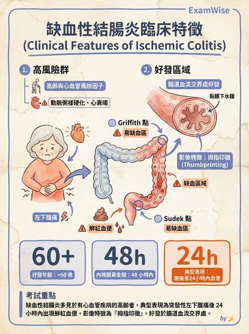 內專 - 憩室病、缺血性腸病與消化道出血 - AI 圖文解析預覽