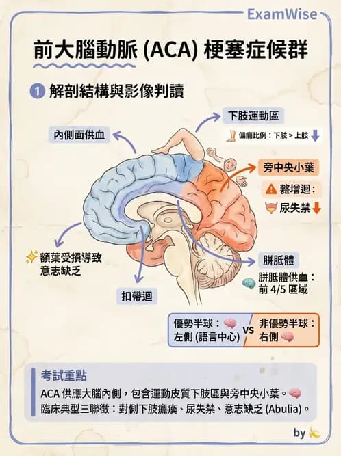 物治 - 腦中風病理與血管解剖 - AI 圖文解析預覽