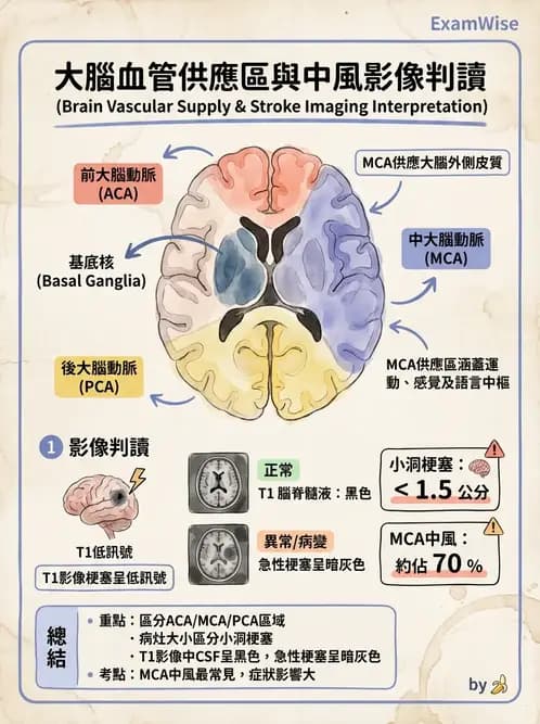 物治 - 腦中風病理與血管解剖 - AI 圖文解析預覽
