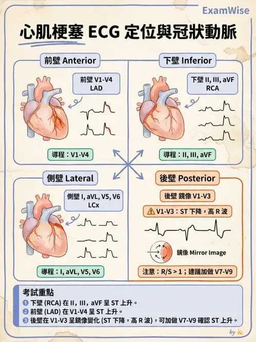 物治 - 心電圖判讀 - AI 圖文解析預覽