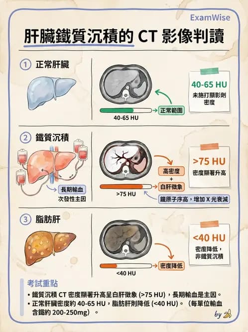 放射 - 胸腹部CT診斷 - AI 圖文解析預覽
