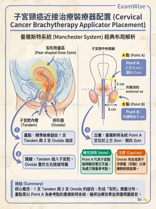 放射 - 腔內近接治療 - AI 圖文解析預覽
