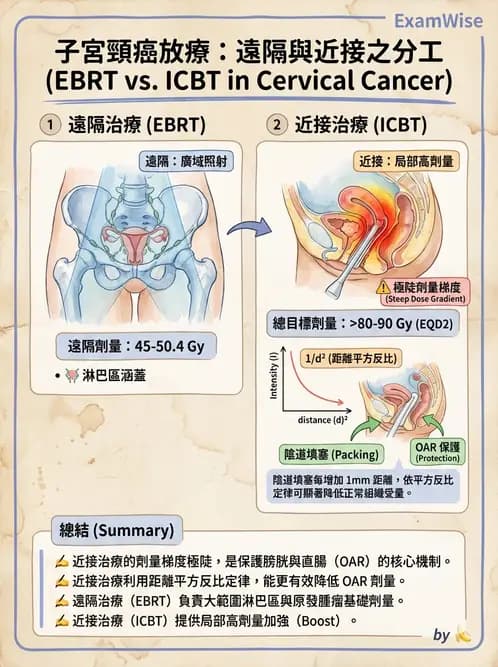 放射 - 腔內近接治療 - AI 圖文解析預覽