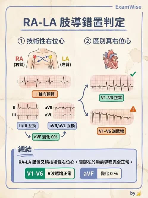 醫檢師 - 心電圖基礎與判讀 - AI 圖文解析預覽