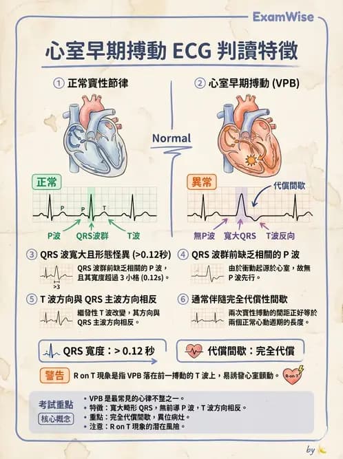 醫檢師 - 心律不整判讀 - AI 圖文解析預覽