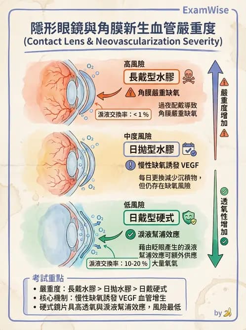 驗光師 - 角膜缺氧、水腫與變形 - AI 圖文解析預覽