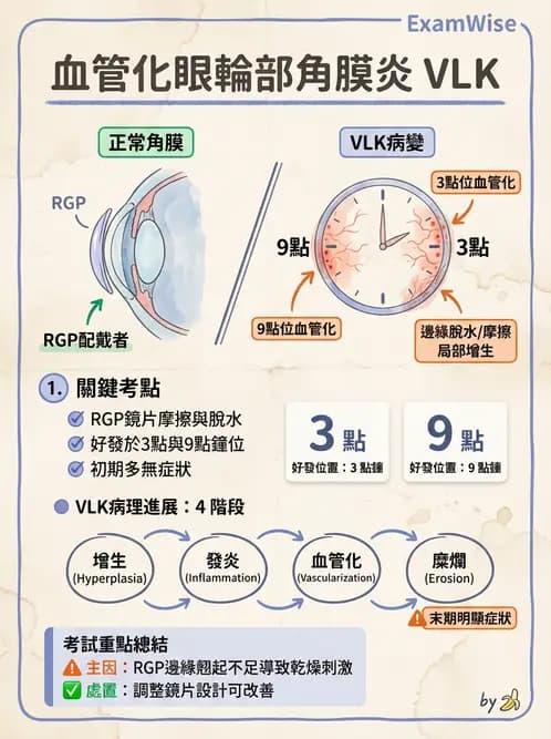 驗光師 - 角膜染色與輪部血管化 - AI 圖文解析預覽