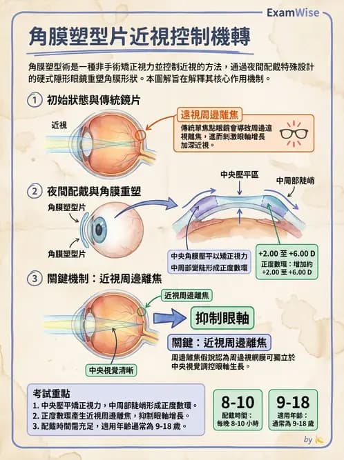 驗光師 - 特殊隱形眼鏡驗配 - AI 圖文解析預覽