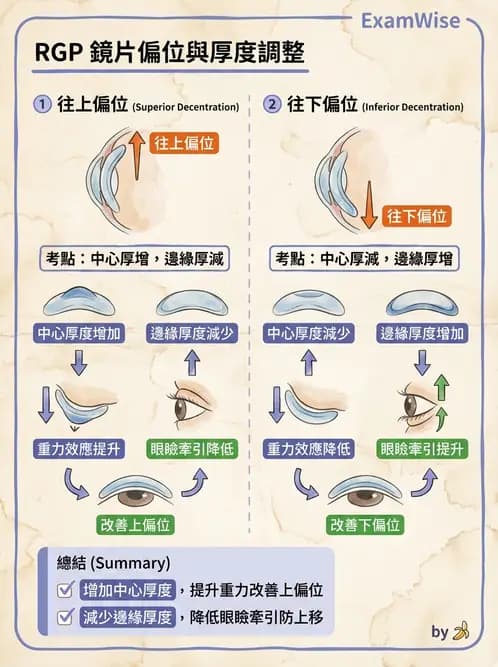 驗光師 - 硬式隱形眼鏡驗配與螢光判讀 - AI 圖文解析預覽