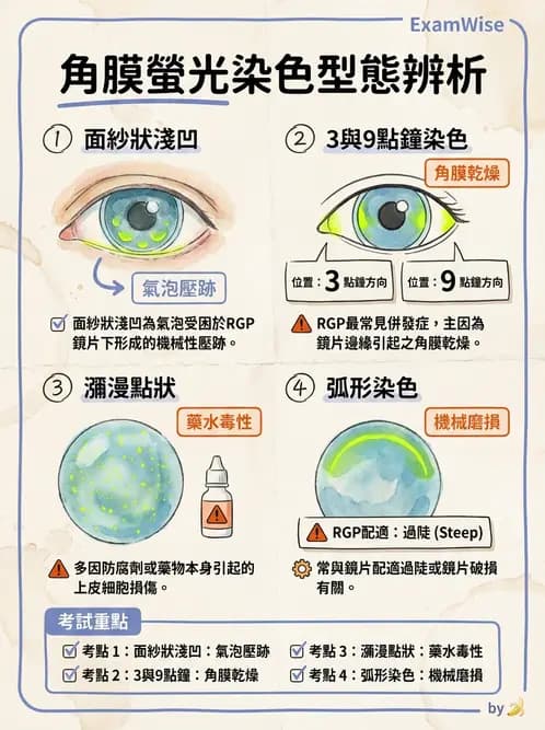 驗光師 - 角膜染色與輪部血管化 - AI 圖文解析預覽