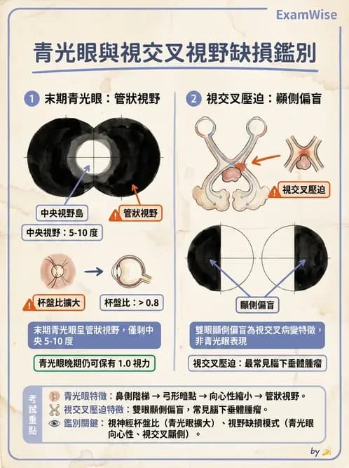驗光師 - 青光眼分類、病因與危險因子 - AI 圖文解析預覽