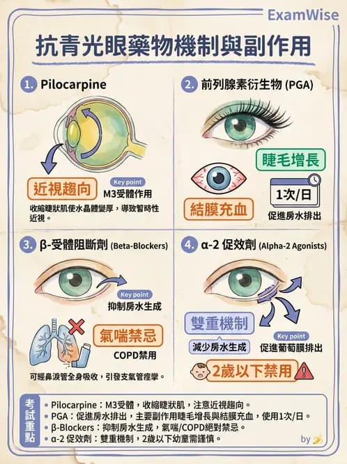 驗光師 - 青光眼診斷與治療 - AI 圖文解析預覽