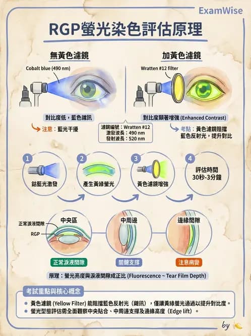 驗光生 - 硬式隱形眼鏡螢光染色評估與特殊臨床適應症 - AI 圖文解析預覽