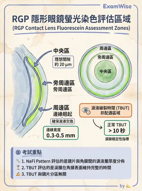 驗光生 - 硬式隱形眼鏡螢光染色評估與特殊臨床適應症 - AI 圖文解析預覽