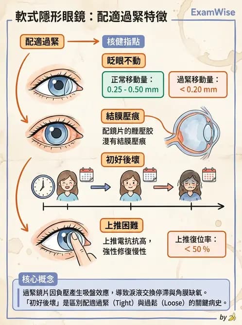 驗光生 - 軟式鏡片配適評估與臨床調整 - AI 圖文解析預覽