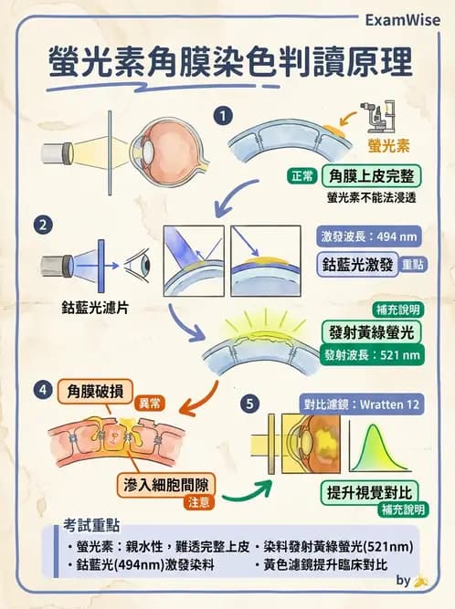 驗光生 - 硬式隱形眼鏡螢光染色評估與特殊臨床適應症 - AI 圖文解析預覽