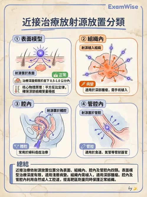 放射 - 近接治療機 - AI 圖文解析預覽