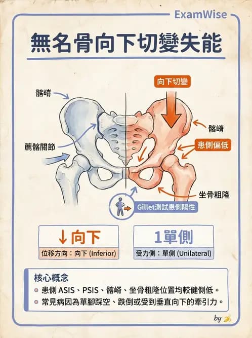 物治 - 薦髂關節評估與治療 - AI 圖文解析預覽
