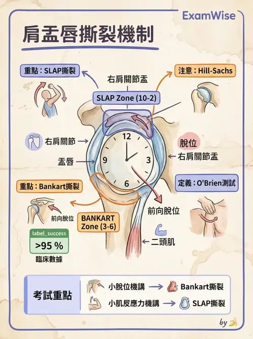 物治 - 肩關節不穩定與盂唇損傷 - AI 圖文解析預覽