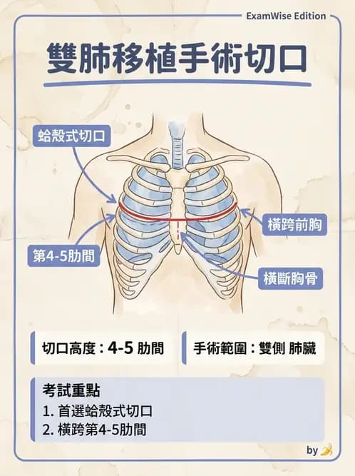 物治 - 胸腔手術、肺移植與呼吸器 - AI 圖文解析預覽