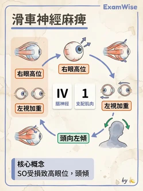 驗光師 - 眼部腦神經解剖與麻痺 - AI 圖文解析預覽