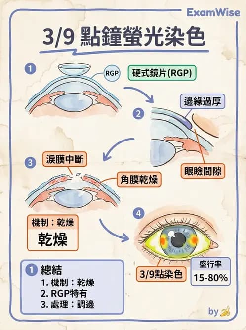 驗光師 - 角膜染色與輪部血管化 - AI 圖文解析預覽