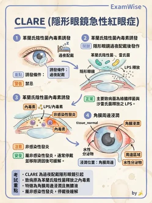 驗光師 - 感染性角膜炎與急性紅眼 - AI 圖文解析預覽