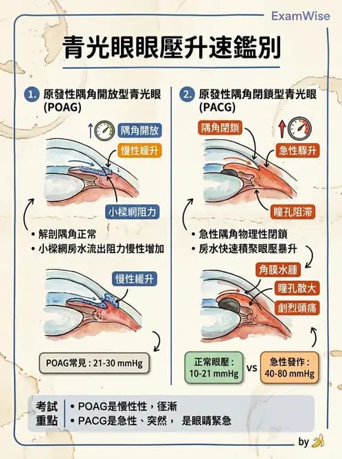 驗光師 - 青光眼分類、病因與危險因子 - AI 圖文解析預覽