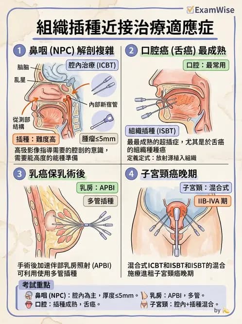放射 - 插種近接治療 - AI 圖文解析預覽