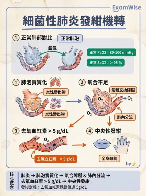 護理師 - 肺炎與呼吸道感染 - AI 圖文解析預覽