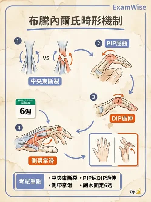 物治 - 手部生物力學 - AI 圖文解析預覽
