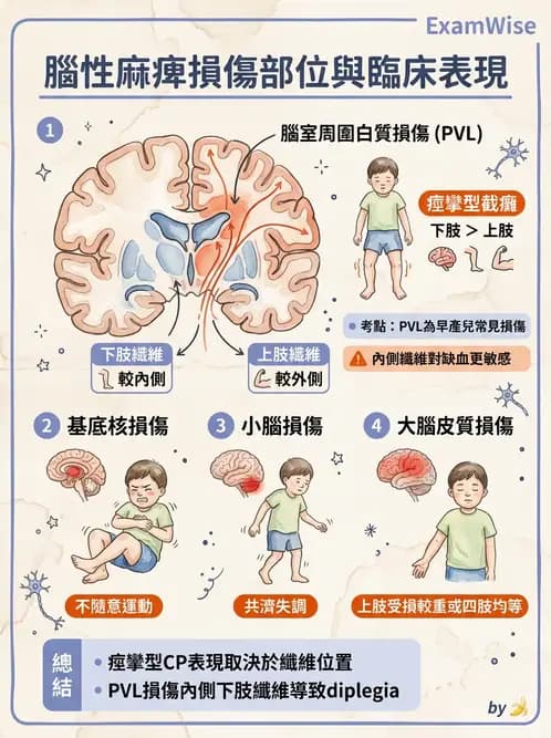 物治 - 腦性麻痺分類、評估與步態 - AI 圖文解析預覽