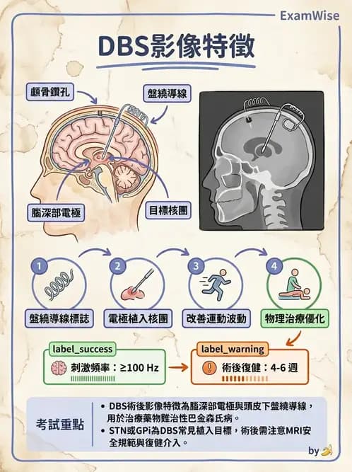 物治 - 巴金森氏病物理治療 - AI 圖文解析預覽