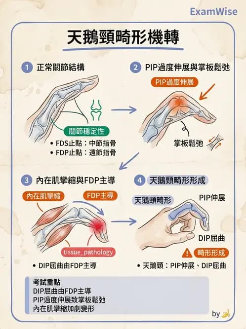 物治 - 手部生物力學 - AI 圖文解析預覽