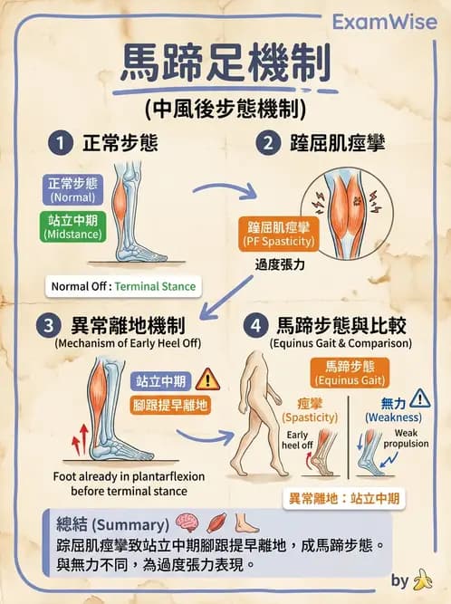 物治 - 腦中風步態分析與行走訓練 - AI 圖文解析預覽