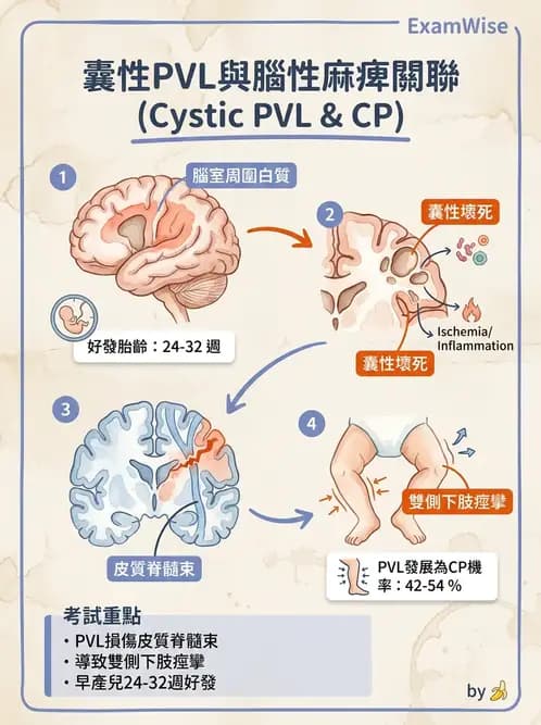 物治 - 腦性麻痺分類、評估與步態 - AI 圖文解析預覽