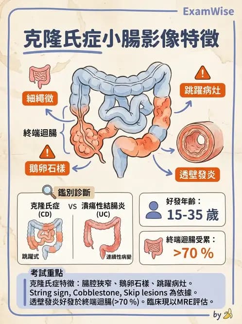 內專 - 發炎性腸道疾病 - AI 圖文解析預覽