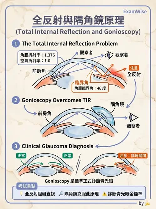 驗光師 - 折射定律、反射與光學現象 - AI 圖文解析預覽