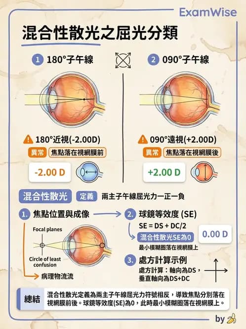 驗光師 - 散光、不等視與不等像 - AI 圖文解析預覽