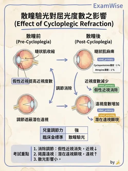 驗光師 - 自覺式驗光流程與球面度判讀 - AI 圖文解析預覽