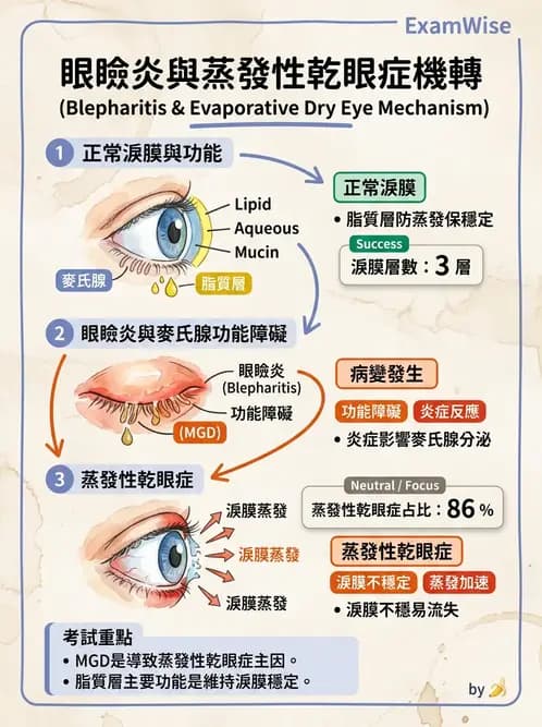 驗光師 - 角膜退化疾病與眼表問題 - AI 圖文解析預覽